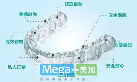 隐形矫正是什么