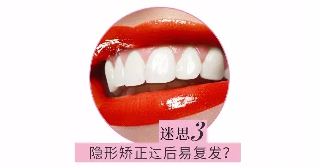 隐形矫正过后易复发?