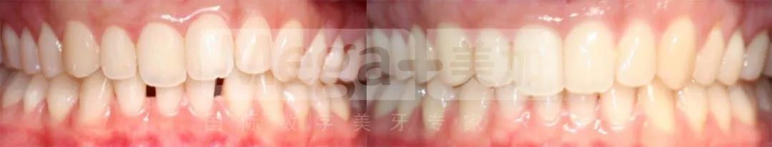 正文图片