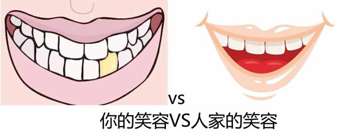 5种常见的牙齿美白方式大PK,看你适合哪一种