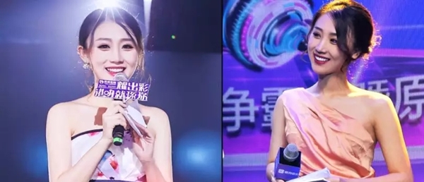 女神的美牙秘密:美加美牙贴面!