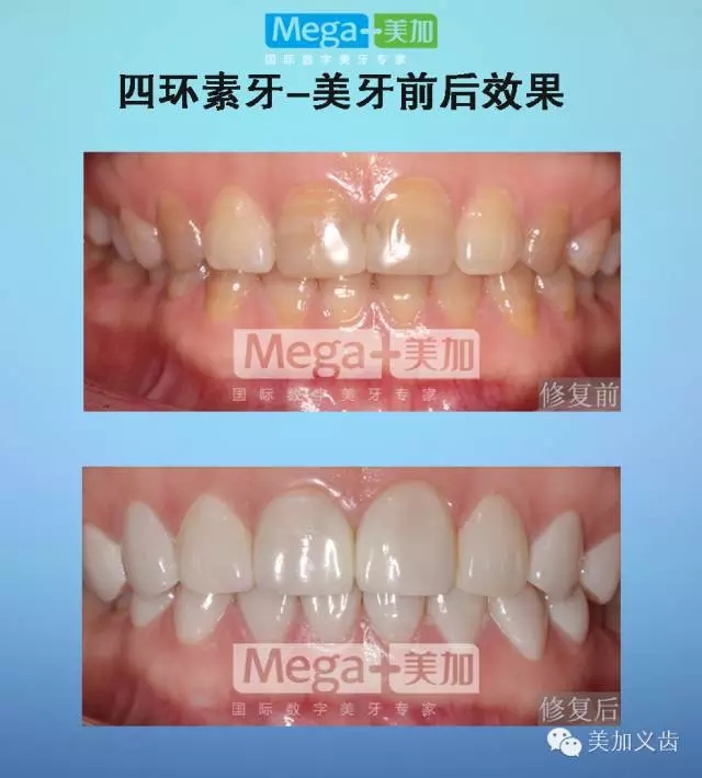 正文图片