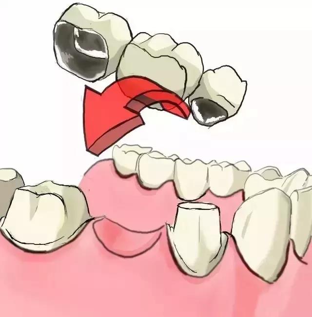 正文图片