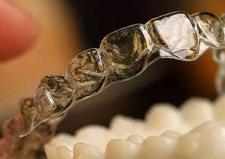 隐形矫正器效果怎么样