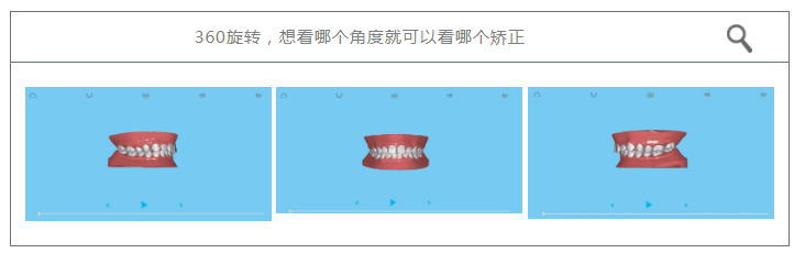 正文图片