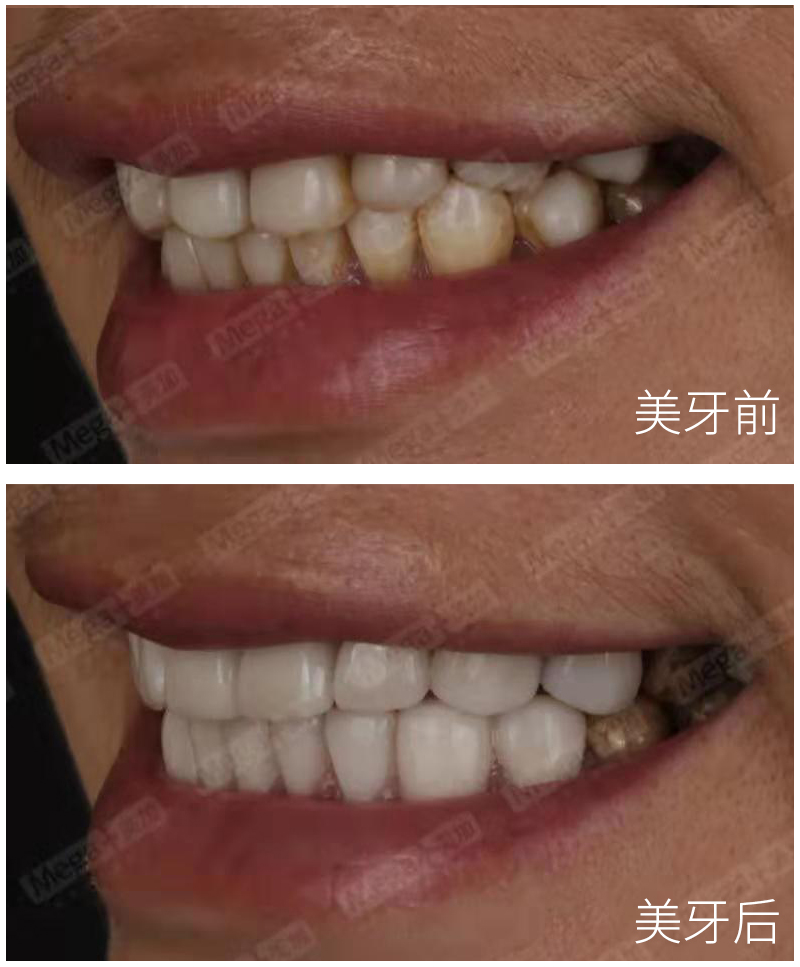 正文图片