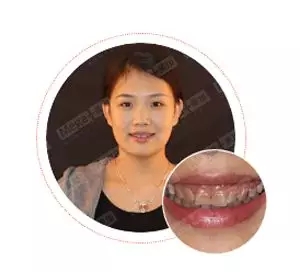 美加美牙,用笑容唤醒美丽人生
