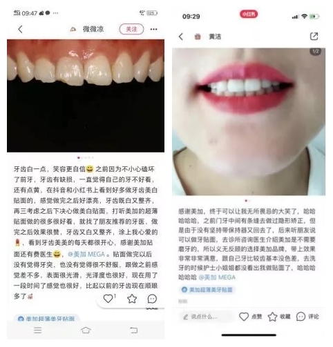 小红书上小姐姐在种草美加贴面