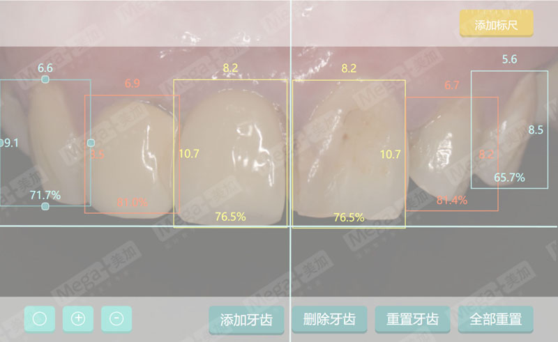 补牙