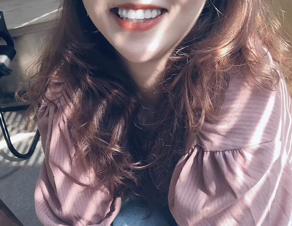 易齐微矫案例:爱美没有终点,但健康会美得比较久