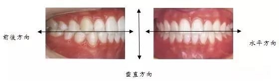 正文图片