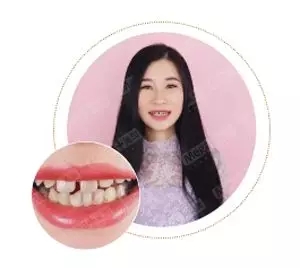 美加美牙,用笑容唤醒美丽人生