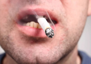 去除烟渍牙