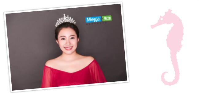 嘉嘉易齐微矫后