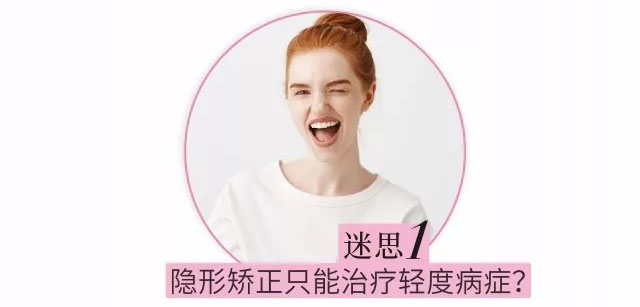 隐形矫正只能治疗轻度病症?