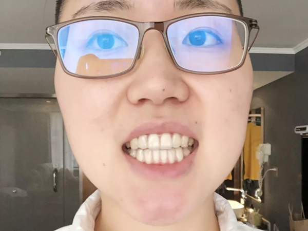牙套ing：效果取决于依从性