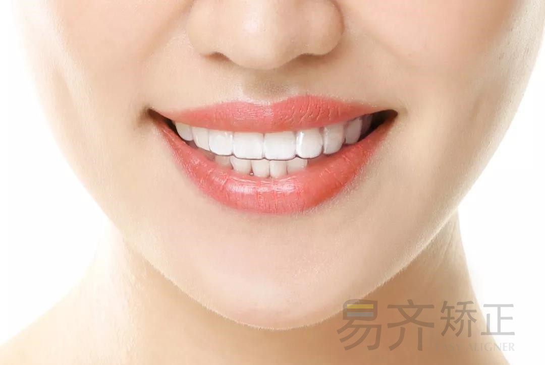 正文图片