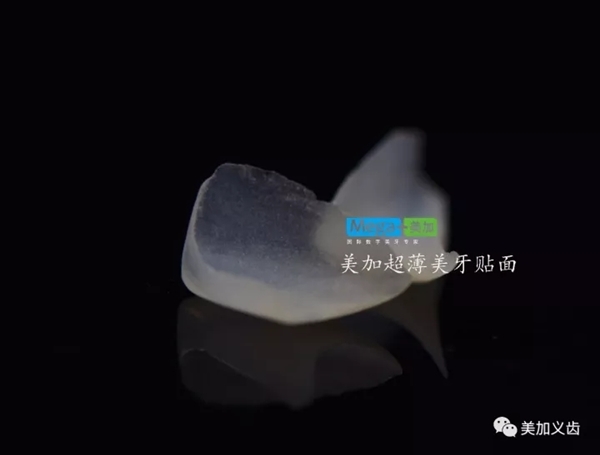 案例来源:上海华美齿科安娟医生
