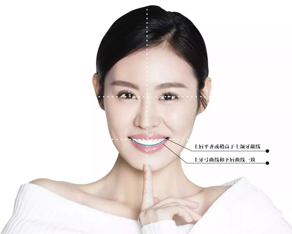 易齐微矫正牙齿更整齐