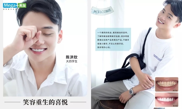 阳光笑容有bug,没关系,美加贴面来帮你