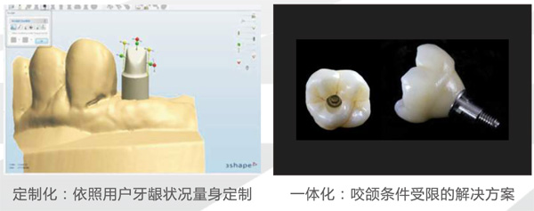 美加个性化种植基台 产品详情图 1