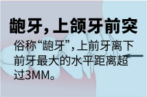 龅牙，上颌牙前突